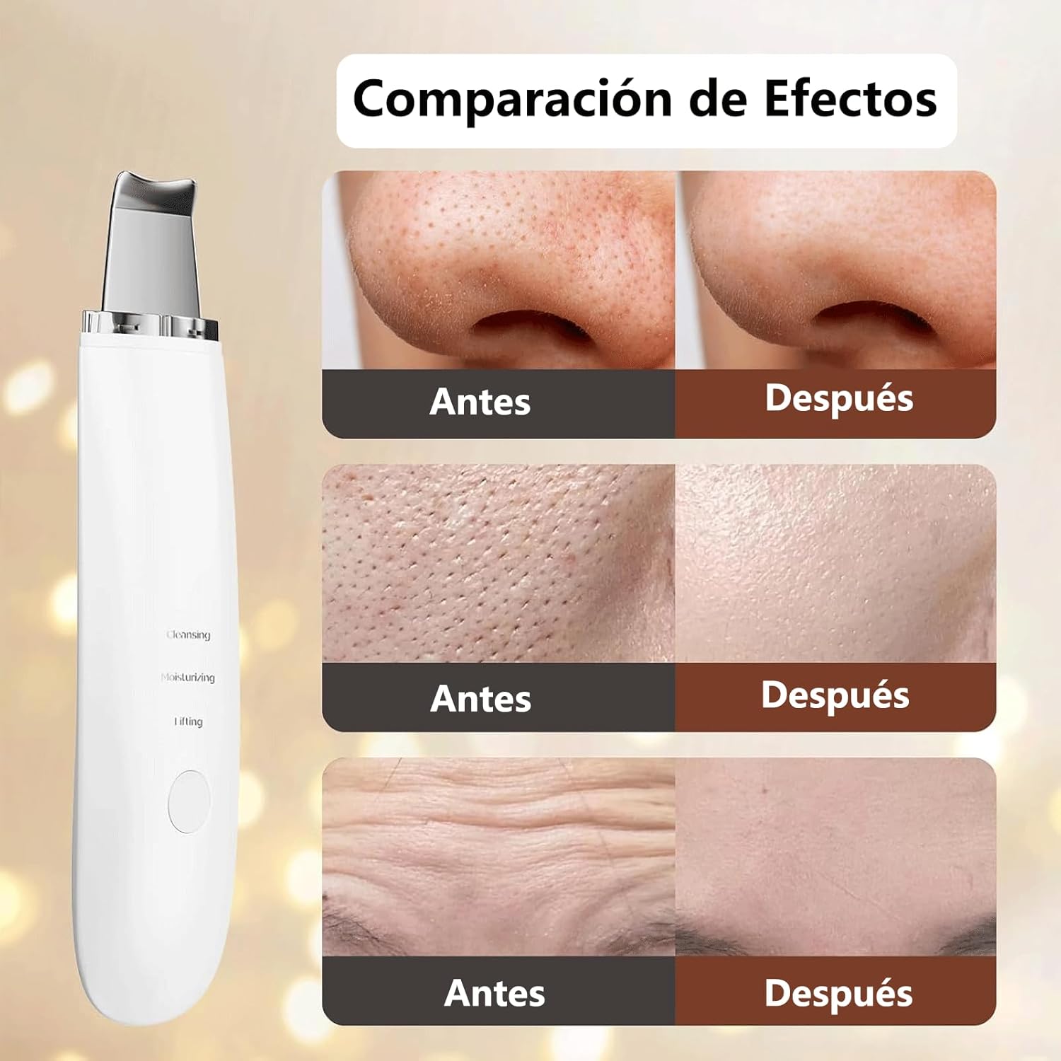 Removedor de impurezas y puntos negros ultrasónico