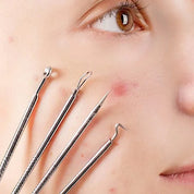 Set profesional para puntos negros